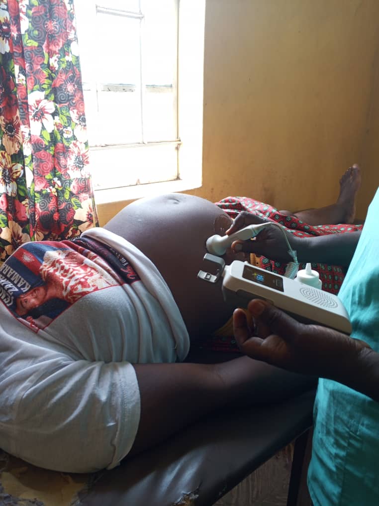 Fetal Doppler being used during maternal care